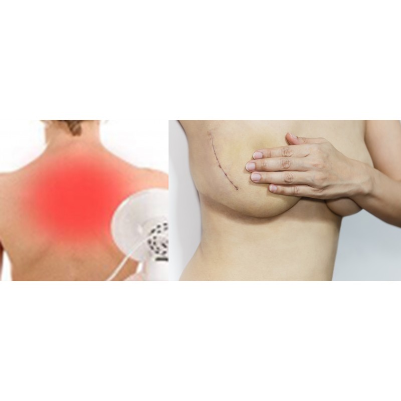 Płyn przyspieszający gojenie ran ze srebrem Cerasept+ 500 ml