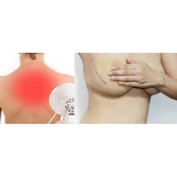 Płyn Po Radioterapii i Mastektomii Cerasept + Antybakteryjny 100ml