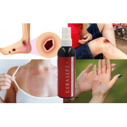 Płyn Po Radioterapii i Mastektomii Cerasept + Antybakteryjny 100ml