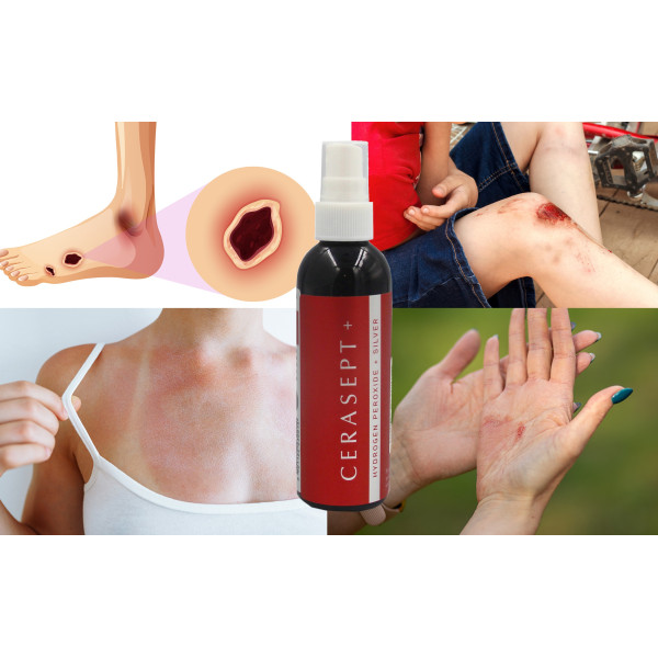Płyn Po Radioterapii i Mastektomii Cerasept + Antybakteryjny 100ml