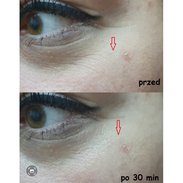 Serum do twarzy wygładzające przeciwzmarszczkowe Nachemii 30 ml